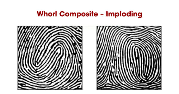Chủng vân tay Composite – Imploding
